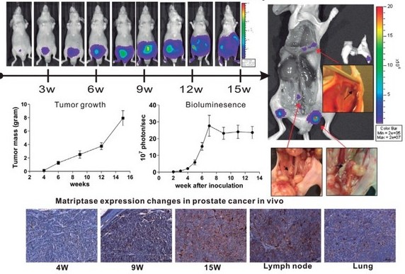 Characterization of prostate cancer progression model to test herbal remedy